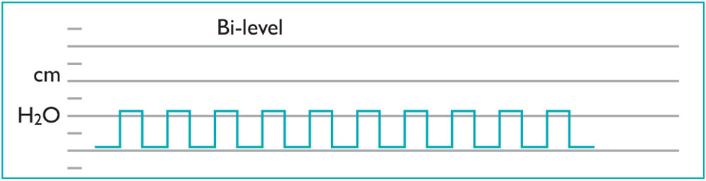 bi-level-system