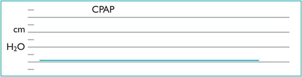 cpap-system